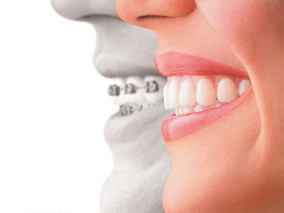 Smile Village Dental Care | Dentures, Emergency Treatment and Preventative Program