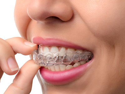 Smile Village Dental Care | Dentures, Dental Cleanings and Oral Cancer Screening