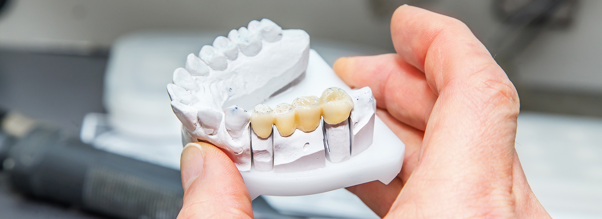 Smile Village Dental Care | Dental Cleanings, Oral Cancer Screening and Sedation Dentistry