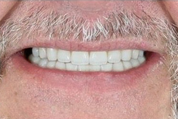 Smile Village Dental Care | Oral Exams, Sleep Apnea and Sedation Dentistry