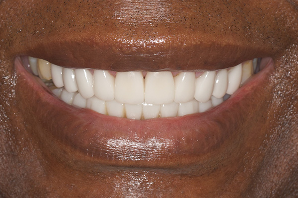 Smile Village Dental Care | Smile Makeover, Dental Bridges and Dental Fillings