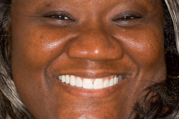 Smile Village Dental Care | Night Guards, Cosmetic Dentistry and Sedation Dentistry