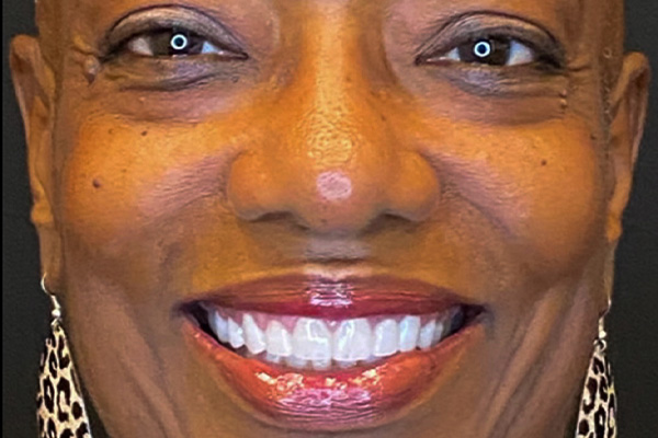 Smile Village Dental Care | Dentures, Invisalign® and Emergency Treatment