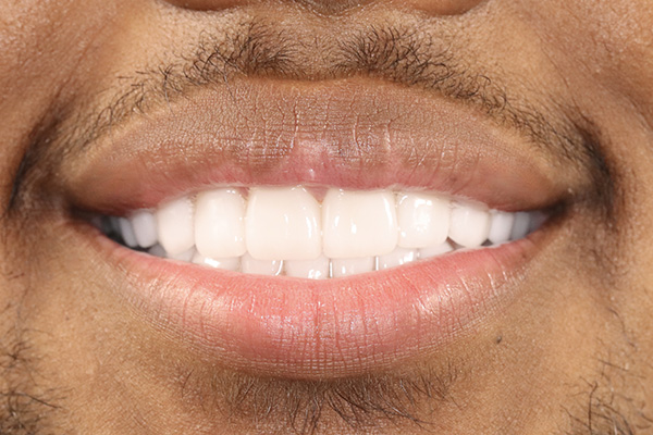 Pearland Cosmetic Dentist