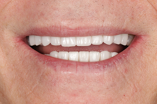 Smile Village Dental Care | Dental Bridges, Emergency Treatment and Cosmetic Dentistry