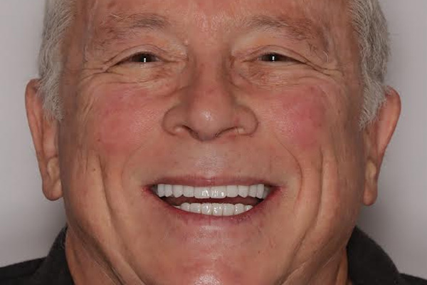 Smile Village Dental Care | Oral Exams, Night Guards and Sedation Dentistry