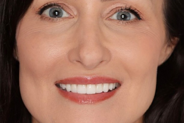 Smile Village Dental Care | Oral Cancer Screening, K  R reg Teeth Whitening System and Dentures