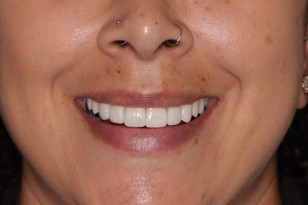 Smile Village Dental Care | Oral Cancer Screening, Periodontal Treatment and Night Guards