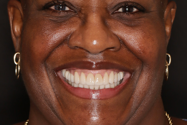 Smile Village Dental Care | Dentures, Snoring Appliances and Dental Fillings