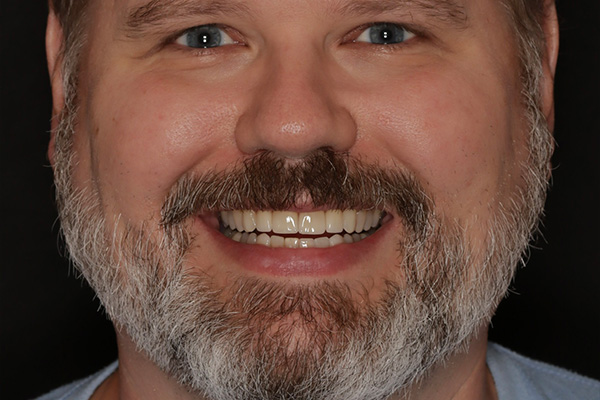 Smile Village Dental Care | Cosmetic Dentistry, Veneers and Oral Surgery  amp  Extractions