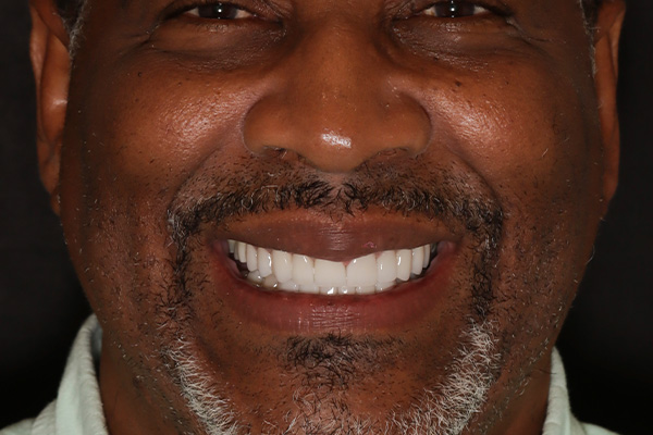 Smile Village Dental Care | Implant Dentistry, Dental Fillings and Smile Makeover