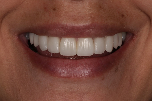 Smile Village Dental Care | All-on-4&reg;, Periodontal Treatment and Dental Bridges