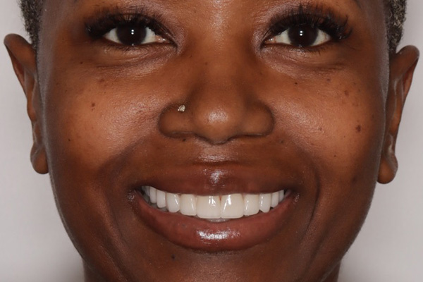 Smile Village Dental Care | Oral Cancer Screening, Oral Surgery & Extractions and Implant Dentistry