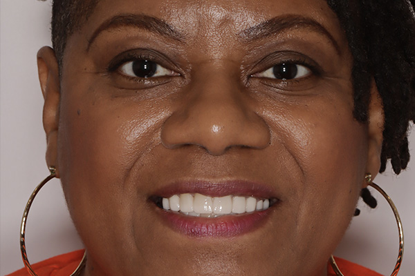 Smile Village Dental Care | Emergency Treatment, Ceramic Crowns and Sedation Dentistry