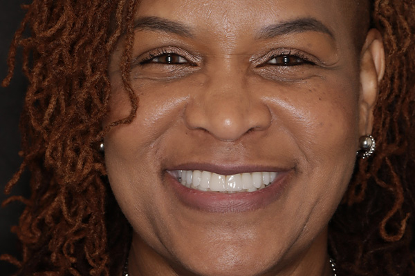 Smile Village Dental Care | K  R reg Teeth Whitening System, Oral Cancer Screening and Periodontal Treatment