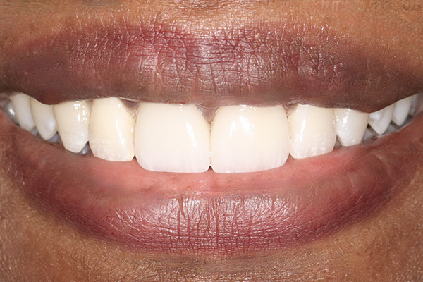 Emergency Dentist Pearland