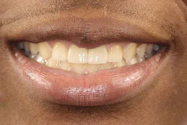 Emergency Dentist Pearland