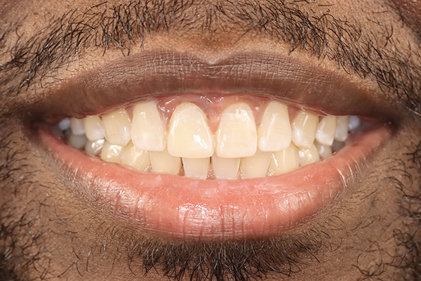 Pearland Cosmetic Dentist