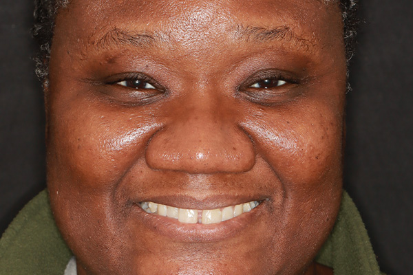 Smile Village Dental Care | K  R reg Teeth Whitening System, Periodontal Treatment and Oral and Maxillofacial Surgery