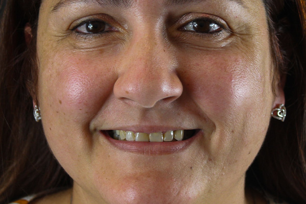 Smile Village Dental Care | Sedation Dentistry, Night Guards and Invisalign reg 