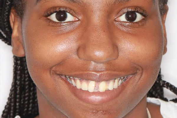 Smile Village Dental Care | Oral Cancer Screening, Periodontal Treatment and Oral Exams