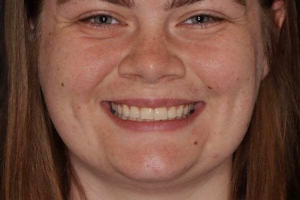 Smile Village Dental Care | Oral Cancer Screening, Sedation Dentistry and Dentures