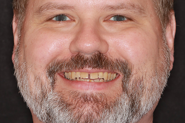 Smile Village Dental Care | Periodontal Treatment, Oral Exams and Dental Fillings