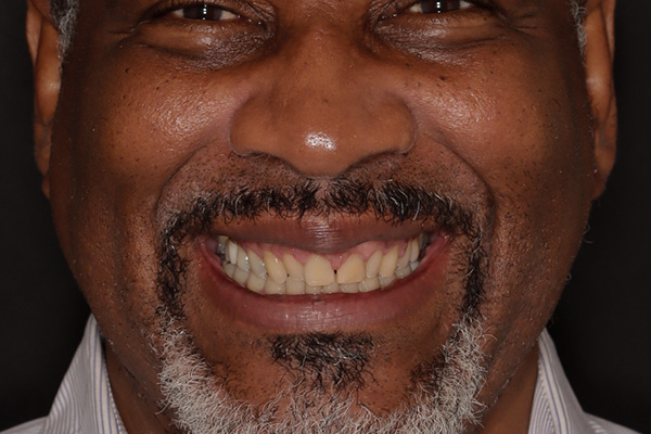 Smile Village Dental Care | Dentures, Sedation Dentistry and Sleep Apnea