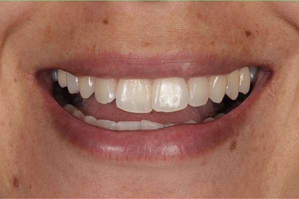 Smile Village Dental Care | Dental Cleanings, Veneers and Dental Bridges