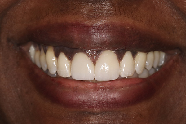 Emergency Dentist Pearland