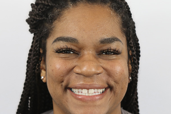 Pearland Cosmetic Dentist