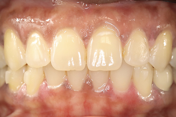 Pearland Cosmetic Dentist