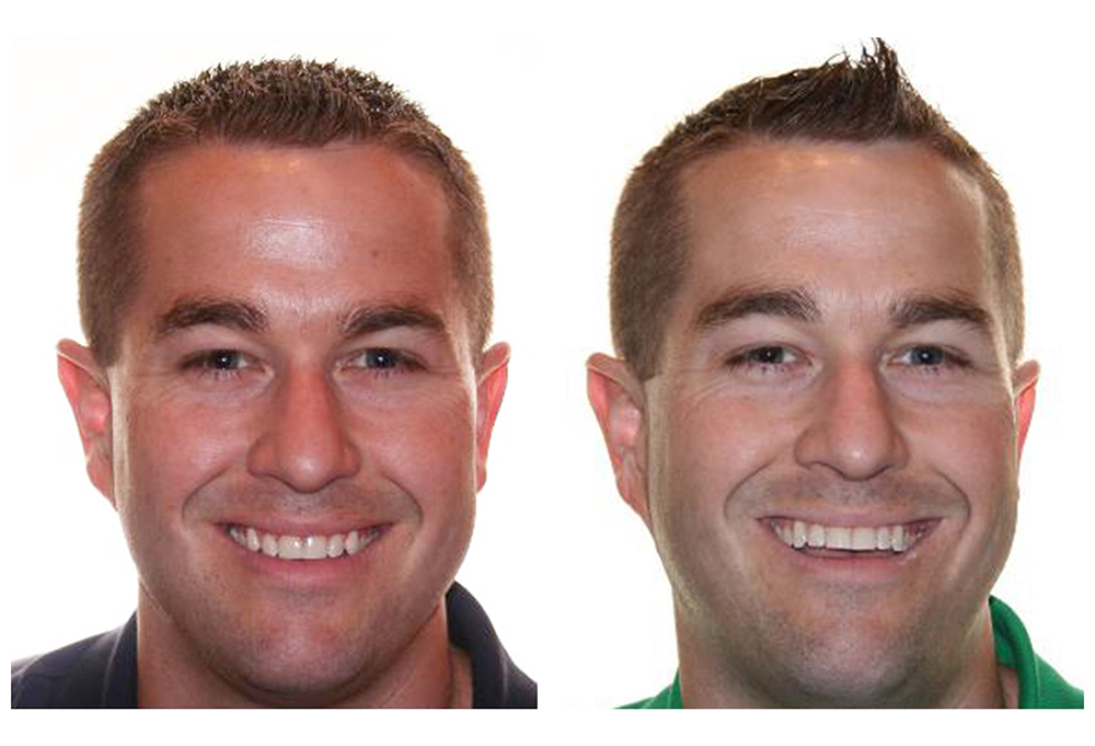 Smile Village Dental Care