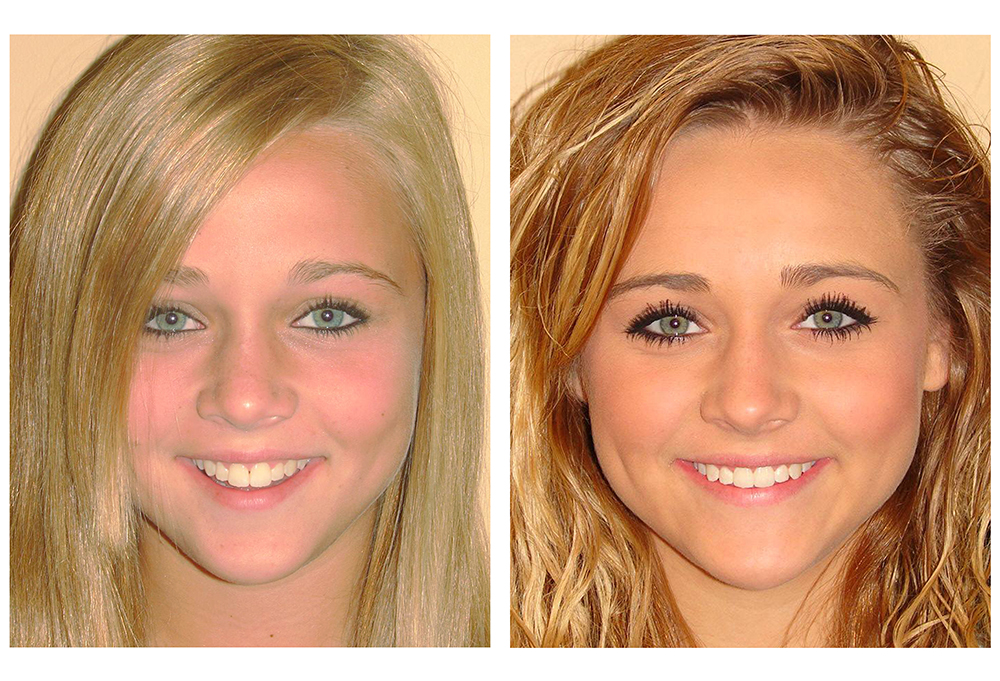 Smile Village Dental Care