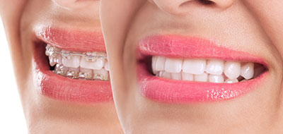 Smile Village Dental Care | Extractions, Oral and Maxillofacial Surgery and Dental Cleanings