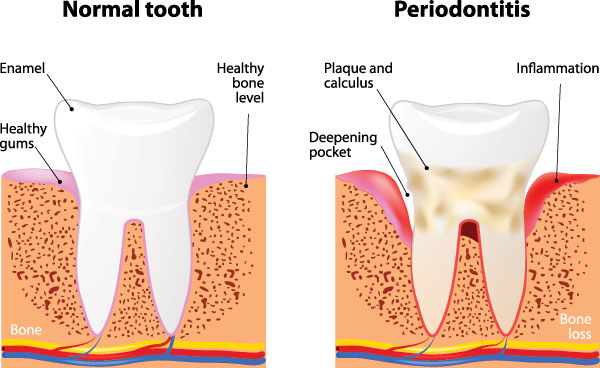 Smile Village Dental Care | All-on-4 reg , Periodontal Treatment and Emergency Treatment